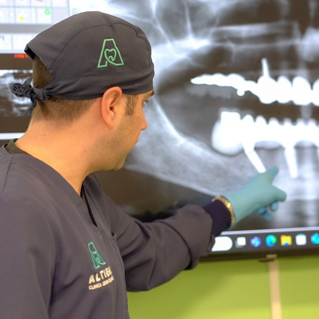 Implantologia 5 Impianto dentale a Verona