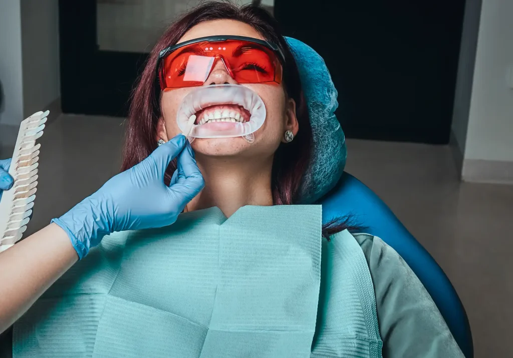 Come funziona lo sbiancamento dentale dal dentista 1 sbiancamento dentale dal dentista
