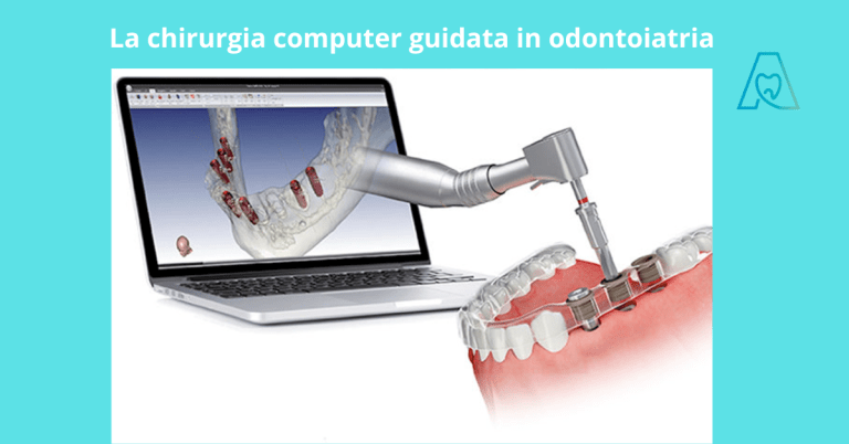 Blog 8 La chirurgia computer guidata